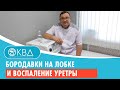 😢 Бородавки на лобке и воспаление уретры. Клинический случай №782