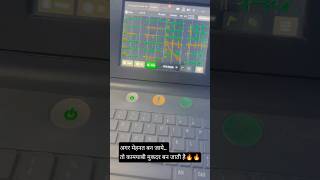 ECG(ELECTROCARDIOGRAM) 🩺@YouTube #shortvideo #viral #electrocardiography #dream