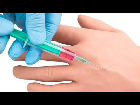 اسهل طريقة لاعطاء حقن الوريد  