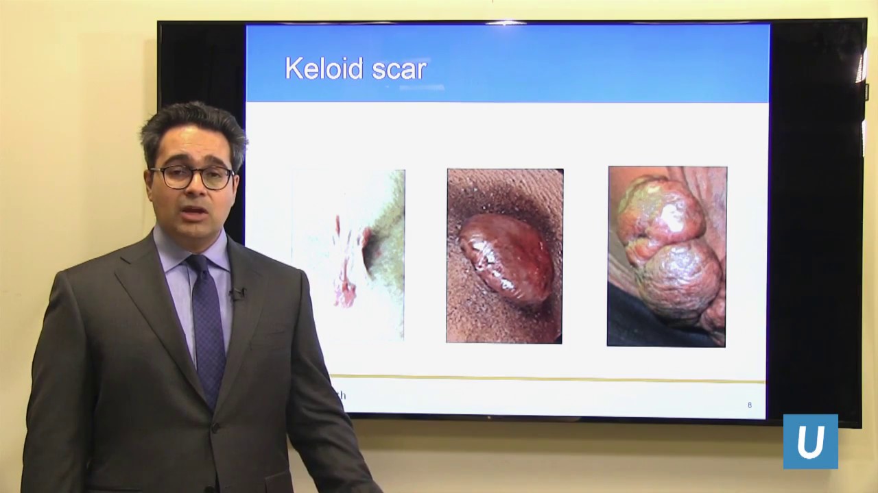 Scar and Keloid Management | Andrew Vardanian, MD | UCLAMDChat