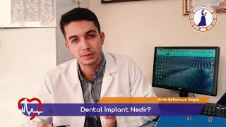 Dental İmplant Nedir?