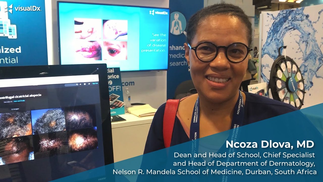 Ncoza Dlova, MD YouTube