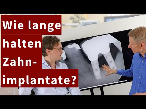 Video: Wie lange halten Ziegelfundamente?