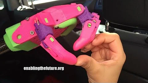 Prosthetic hand by 3D Printer - how 6 year old Maxence made his own superhero hand!