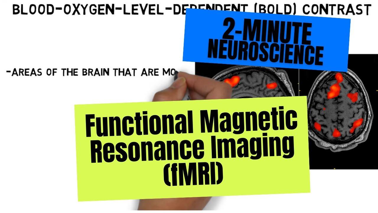 2-Minute Neuroscience: Magnetic Resonance Imaging YouTube