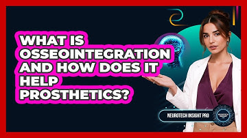 What Is Osseointegration And How Does It Help Prosthetics? - Neurotech Insight Pro