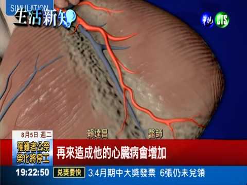 眼冒金星偏頭痛 罹心臟病風險高