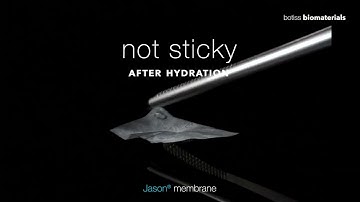 Jason® membrane: Reliable Barrier for GBR/GTR