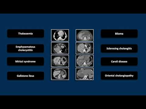 Biliary Emergencies | Interesting Radiology Cases