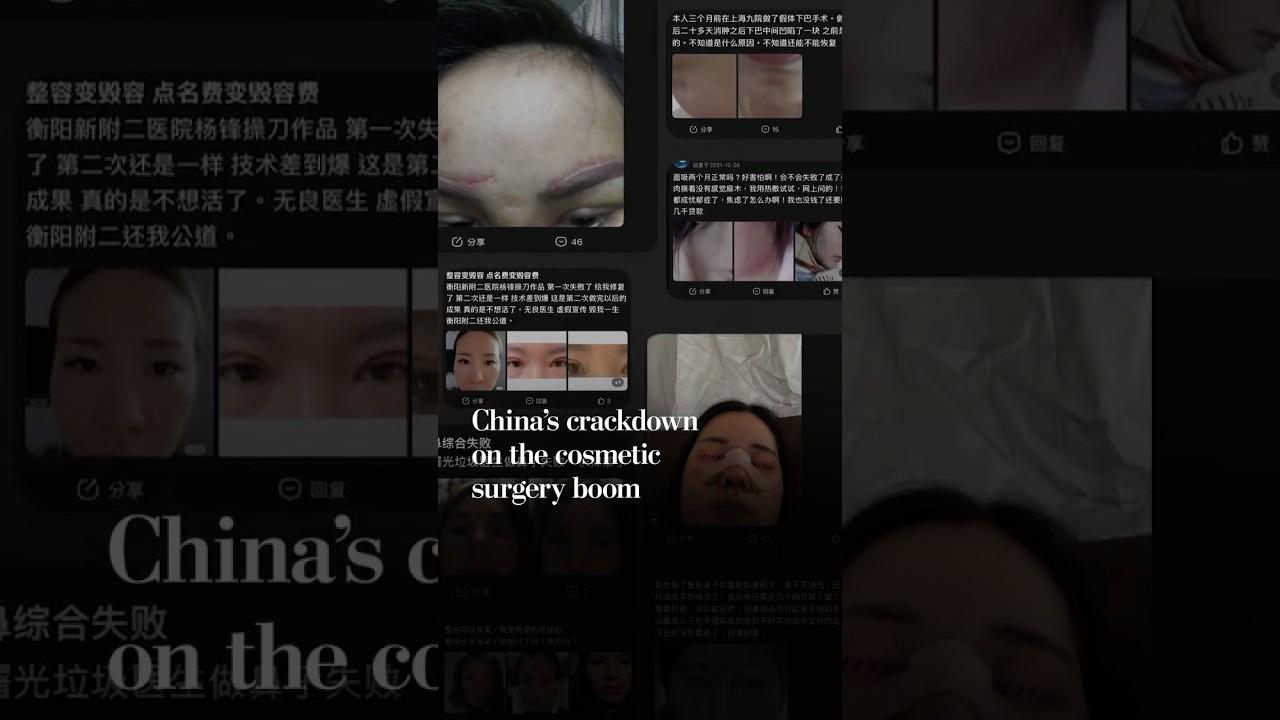 Botched plastic surgeries rise, prompting China crackdown