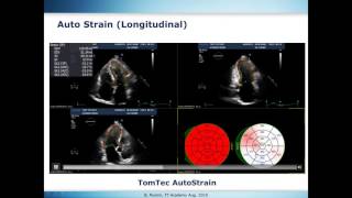 Strain Standardization