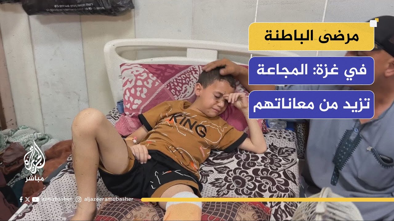 مرضى الباطنة في غزة: المجاعة تزيد من معاناتهم