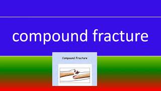 compound fracture