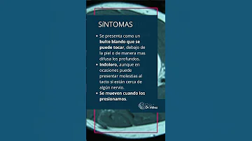 ¿Cómo es el comienzo de un lipoma?