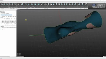 Step4: MediACE3D AFO - InflateMalleous
