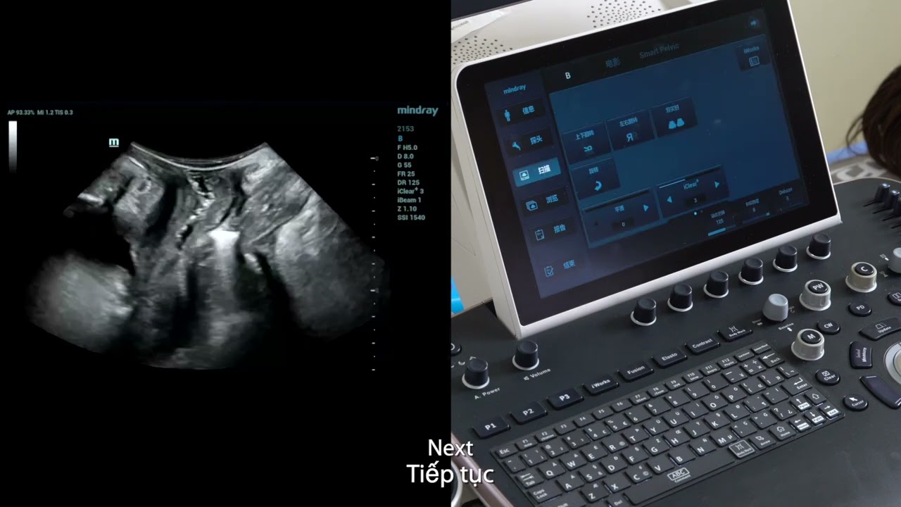 Smart PF standardized examination process routine operation, 2Dmeasurement, 3D imaging Vietnamese