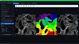 Protein Aggregate Analyzer - Microscopy Analysis Tool - CureQ Lab
