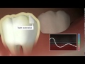 Oral BioTech - CariFree