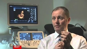 Transformative new blood pressure monitoring device developed by University of Leicester