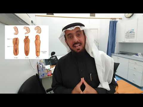 مرض الصلب المشقوق أو السنسنة المشقوقة Spina Bifida