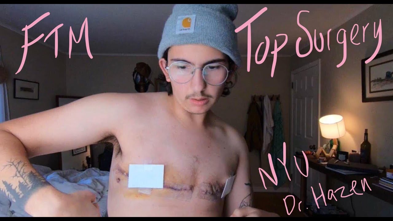 FTM Top Surgery with Dr. Alexes Hazen NYU Langone