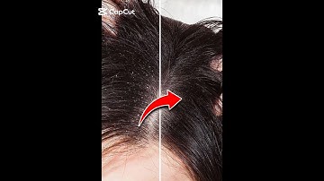 Easy way to remove dandruff from hair in photoshop | how to remove dandruff from hair in photoshop