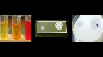 Micro Lab 7: Biochemical Differential Tests- Fermentation, Cellular Respiration, Reduction Potential