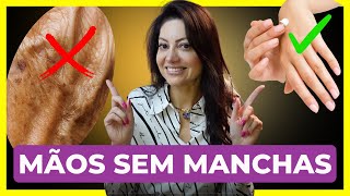 As Melhores Dicas de Cremes Para Mãos Com Manchas e Rugas