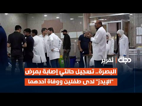 البصرة تسجيل حالتي إصابة بمرض الإي دز لدى طفلين ووف اة أحدهما