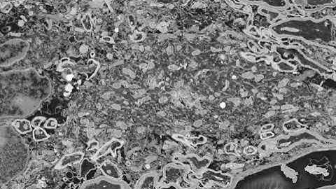 Stack of 2D Electron Microscope images from serial block face scanning electron microscope (SBF-SEM)