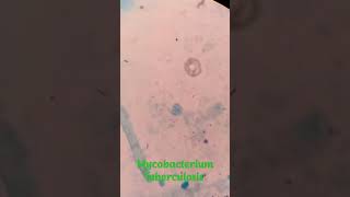 Mycobacterium Tuberculosis under microscope||#shorts