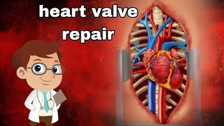 heart valve repair game 🎯🎯🎯🎯🎮🎮 screenshot 4