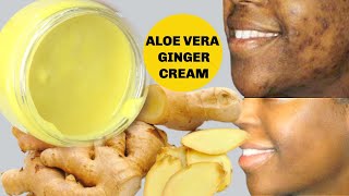 JUST 7 DAYS REMOVE HYPERPIGMENTATION + STRETCH MARKS WITH THIS GINGER CREAM, 100% WORKING