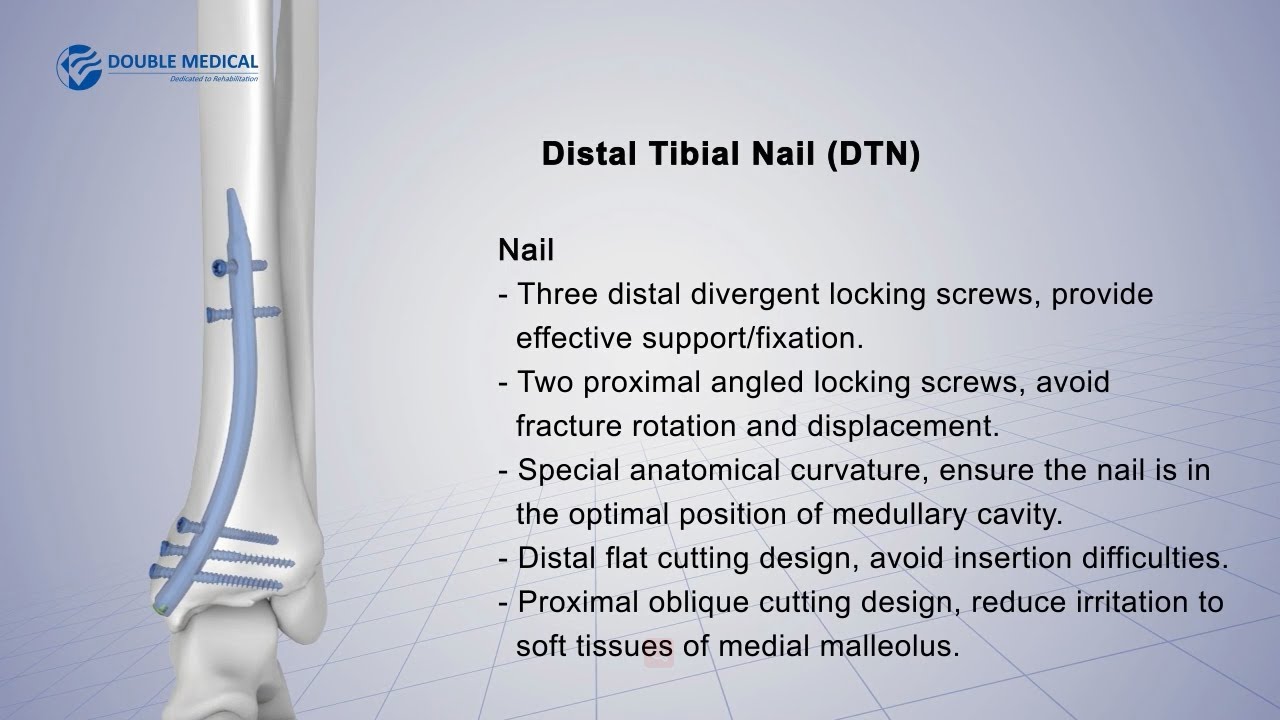 Zimmer® Natural Nail® System Tibial Nail Surgical Technique