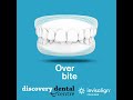 Discovery Dental Invisalign Treatable Cases Discovery Dental Invisalign Treatable Cases
