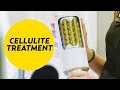 Is this Cellulite Treatment Better than Endermologie? | The SASS with Susan and Sharzad