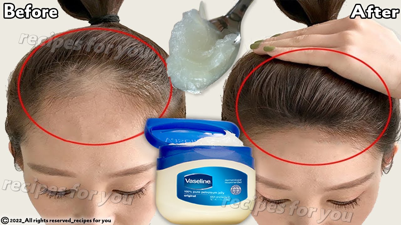 How to use Vaseline for double hair growth your hair will grow 3 times faster