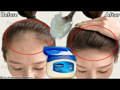 वीडियो: बालों पर वैसलीन लगाने के 3 आसान तरीके