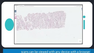 New Microvisioneer InstaSlide 2024 Edition - Share Your Microscope Slide Scans in an Instant!