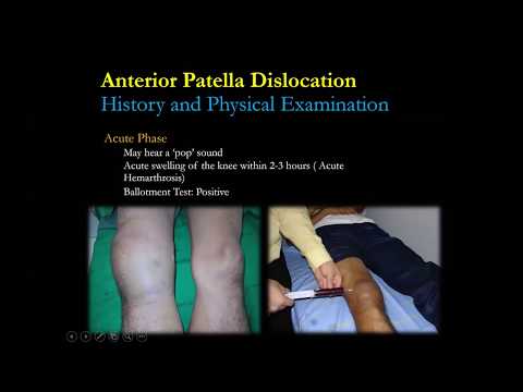 Patella Dislocation and ecurrent instability approach Dr.Bancha Chernchujit รศ.นพ.บัญชา ชื่นชูจิตต์