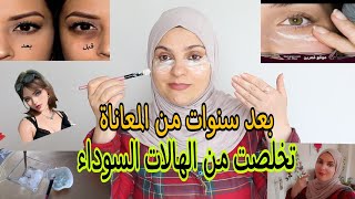 اسرع طريقة للتخلص من الهالات السوداء/لن تحتاجي الى كريم للهالات السوداء?‍️‍️تجهيزات العيدللبنات 