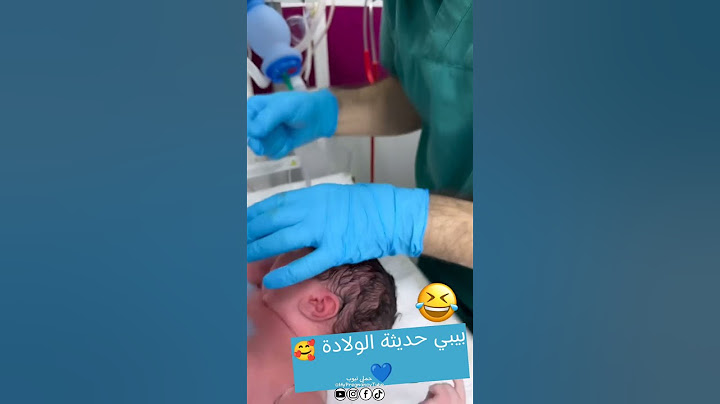 بيبي حديثة الولادة يمسك قفازات الطبيب 😅😍