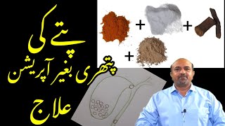 Natural Ways To Prevent Gallbladder Stone | How To Reduce Gallbladder Stone Size | dr afzal