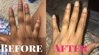 GET RID OF DARK KNUCKLES INSTANTLY HOME REMEDIES IN DAYS/WORKS LIKE MAGIC