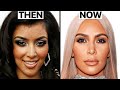 Kim Kardashian's New Face | Plastic Surgery Analysis