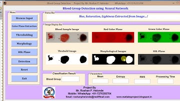 Blood Group Detection using Neural Network Matlab Project Code | Blood Group Prediction Using Matlab