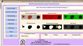 Blood Group Detection using Neural Network Matlab Project Code