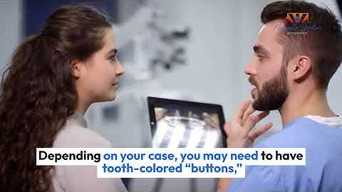 Comparing Invisalign and Spark Aligners