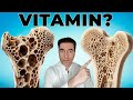 The 1 Vitamin To STOP Osteoporosis After 50 The 1 Vitamin To STOP Osteoporosis After 50
