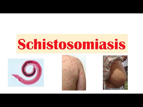 Video: Wat veroorzaakt schistosoma haematobium?